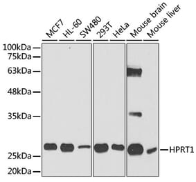 Western Blot - Anti-HPRT Antibody (A14911) - Antibodies.com