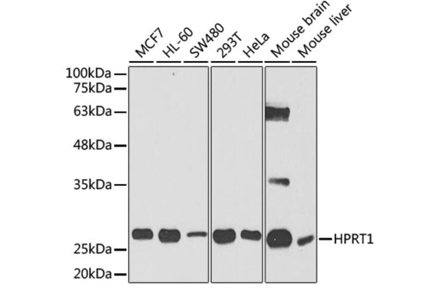 Western Blot - Anti-HPRT Antibody (A14911) - Antibodies.com
