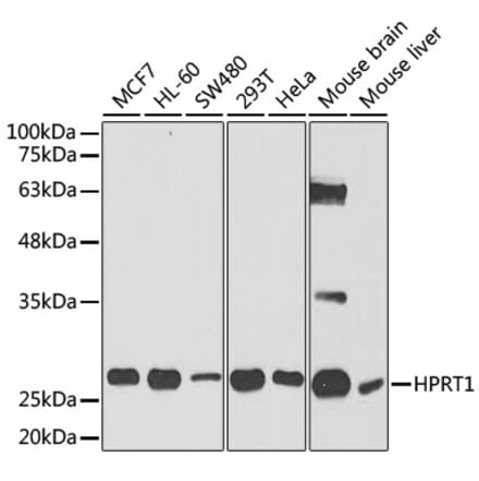 Western Blot - Anti-HPRT Antibody (A14911) - Antibodies.com