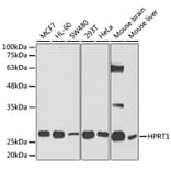 Western Blot - Anti-HPRT Antibody (A14911) - Antibodies.com