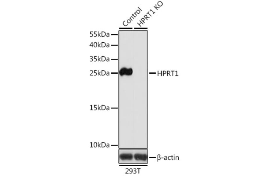 Western Blot - Anti-HPRT Antibody (A14911) - Antibodies.com