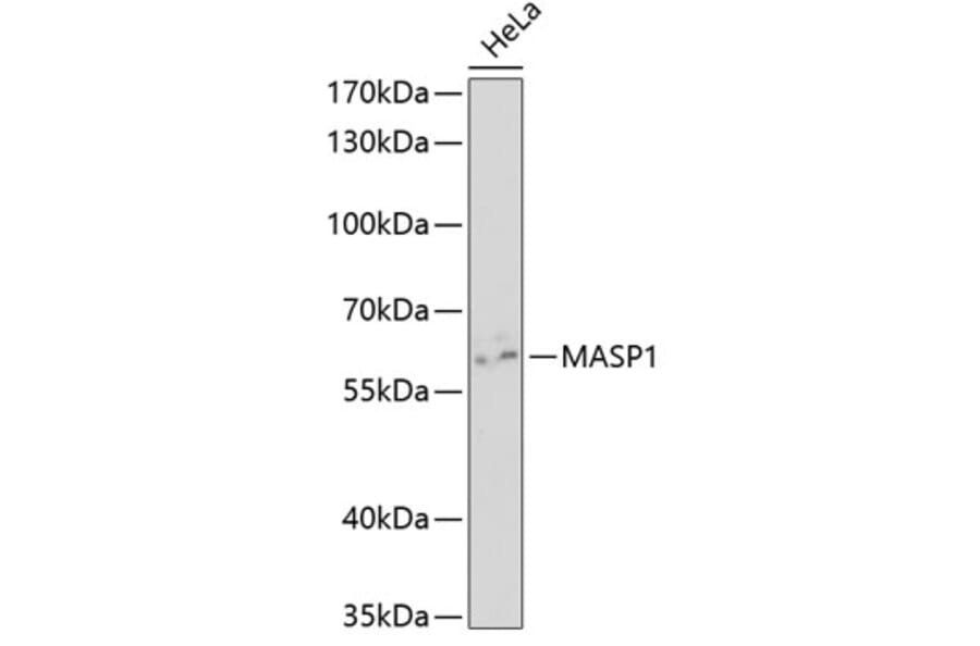 Western Blot - Anti-MASP1 Antibody (A5693) - Antibodies.com