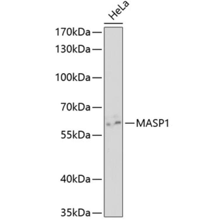 Western Blot - Anti-MASP1 Antibody (A5693) - Antibodies.com