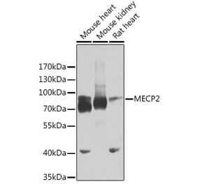 Western Blot - Anti-MeCP2 Antibody (A14913) - Antibodies.com