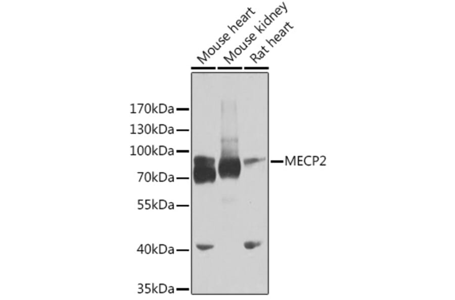 Western Blot - Anti-MeCP2 Antibody (A14913) - Antibodies.com