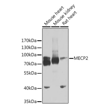 Western Blot - Anti-MeCP2 Antibody (A14913) - Antibodies.com