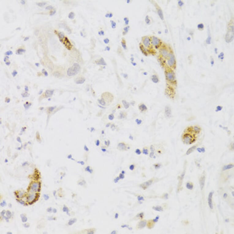 Immunohistochemistry - Anti-PCM1 Antibody (A5696) - Antibodies.com