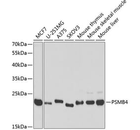 Western Blot - Anti-PSMB4 Antibody (A14915) - Antibodies.com