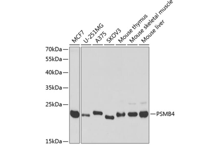 Western Blot - Anti-PSMB4 Antibody (A14915) - Antibodies.com