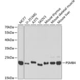 Western Blot - Anti-PSMB4 Antibody (A14915) - Antibodies.com