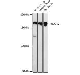 Western Blot - Anti-ROCK2 Antibody (A14916) - Antibodies.com