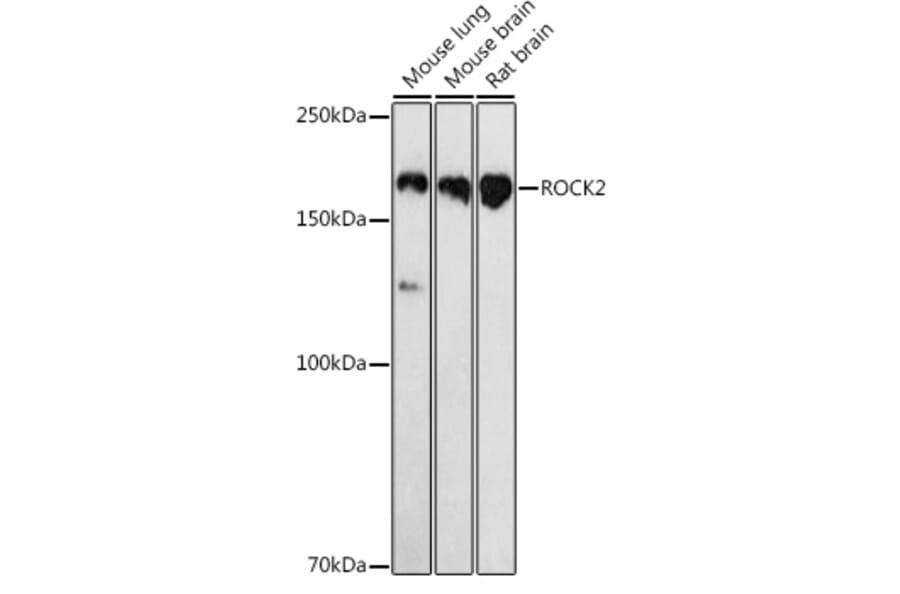 Western Blot - Anti-ROCK2 Antibody (A14916) - Antibodies.com