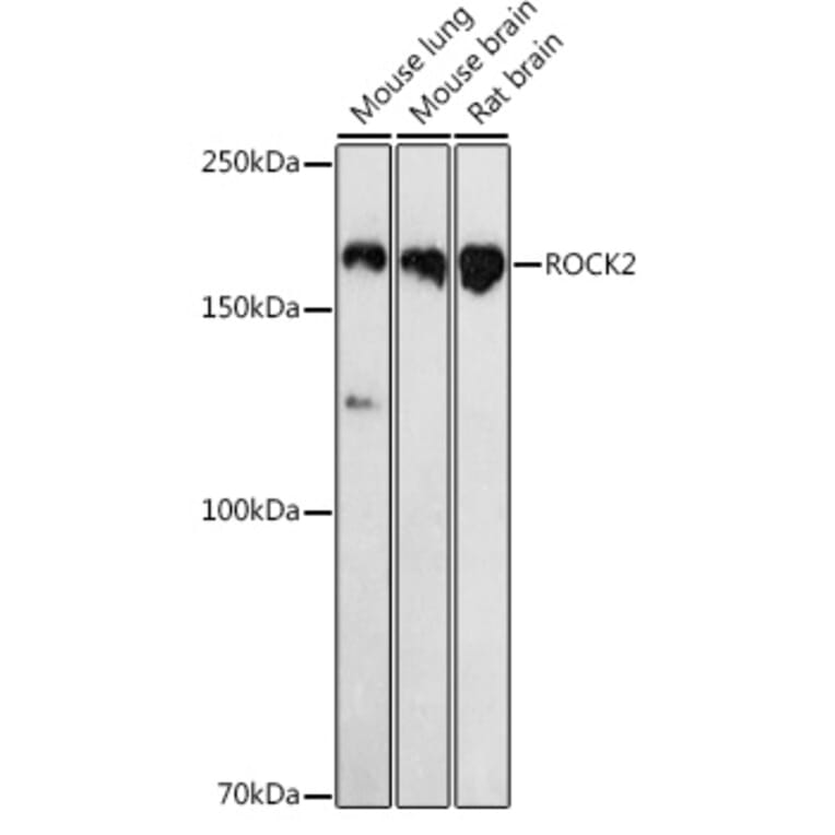 Western Blot - Anti-ROCK2 Antibody (A14916) - Antibodies.com