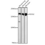 Western Blot - Anti-ROCK2 Antibody (A14916) - Antibodies.com