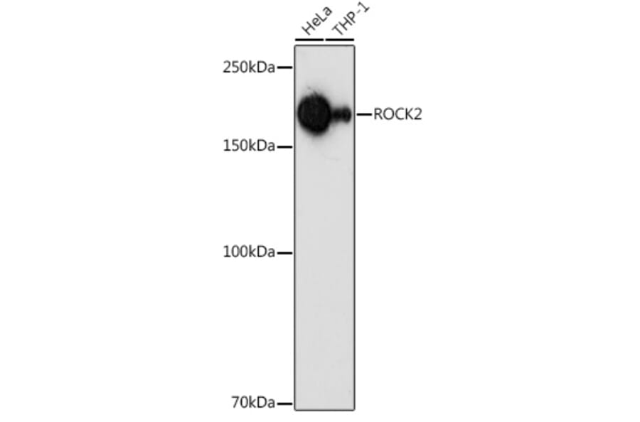 Western Blot - Anti-ROCK2 Antibody (A14916) - Antibodies.com