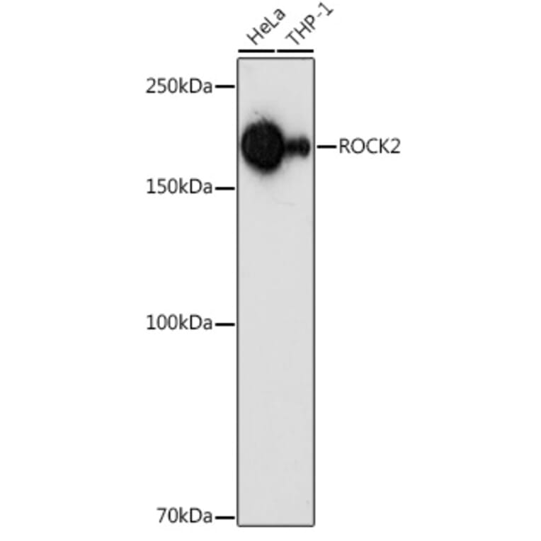 Western Blot - Anti-ROCK2 Antibody (A14916) - Antibodies.com
