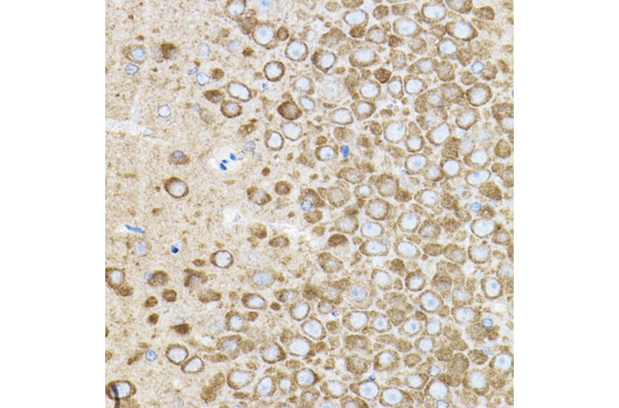Immunohistochemistry - Anti-ROCK2 Antibody (A14916) - Antibodies.com