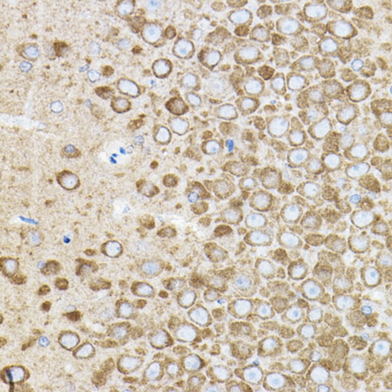 Immunohistochemistry - Anti-ROCK2 Antibody (A14916) - Antibodies.com
