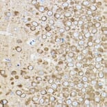 Immunohistochemistry - Anti-ROCK2 Antibody (A14916) - Antibodies.com