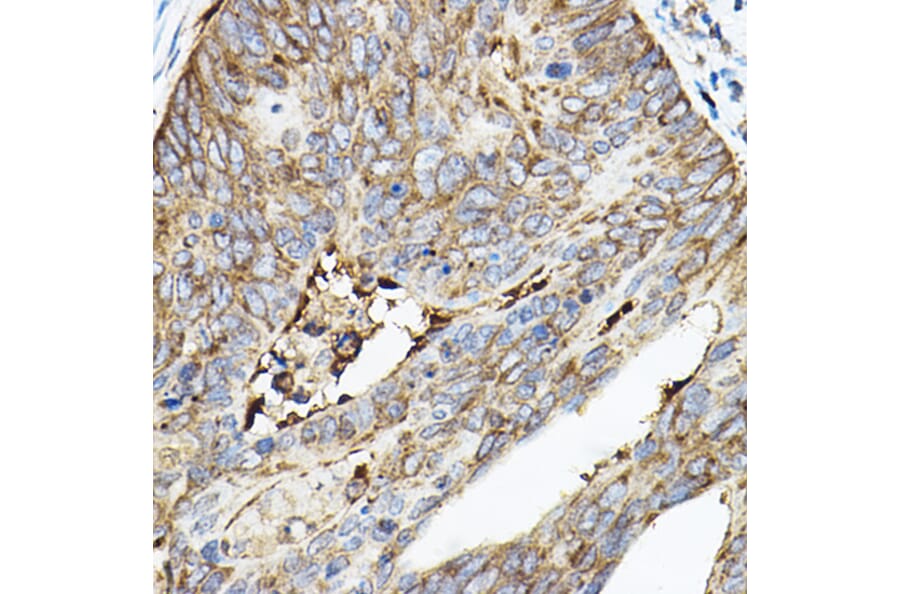 Immunohistochemistry - Anti-ROCK2 Antibody (A14916) - Antibodies.com
