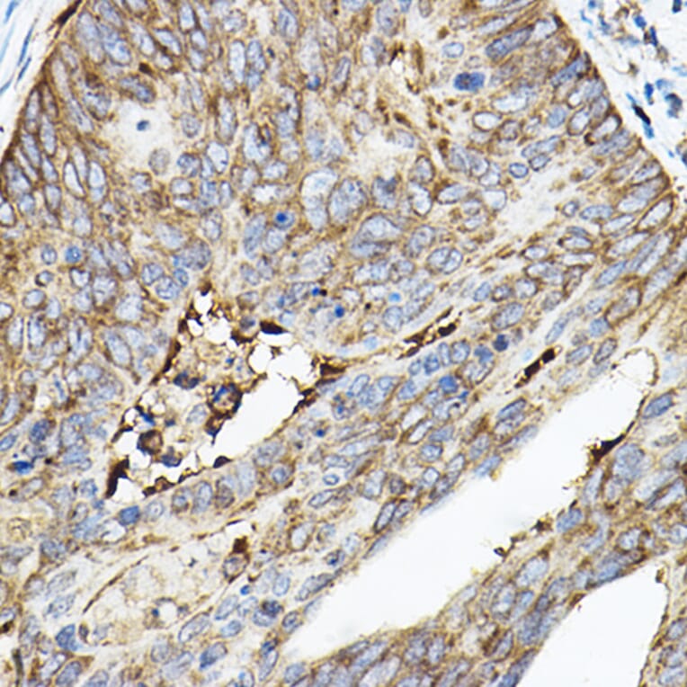 Immunohistochemistry - Anti-ROCK2 Antibody (A14916) - Antibodies.com