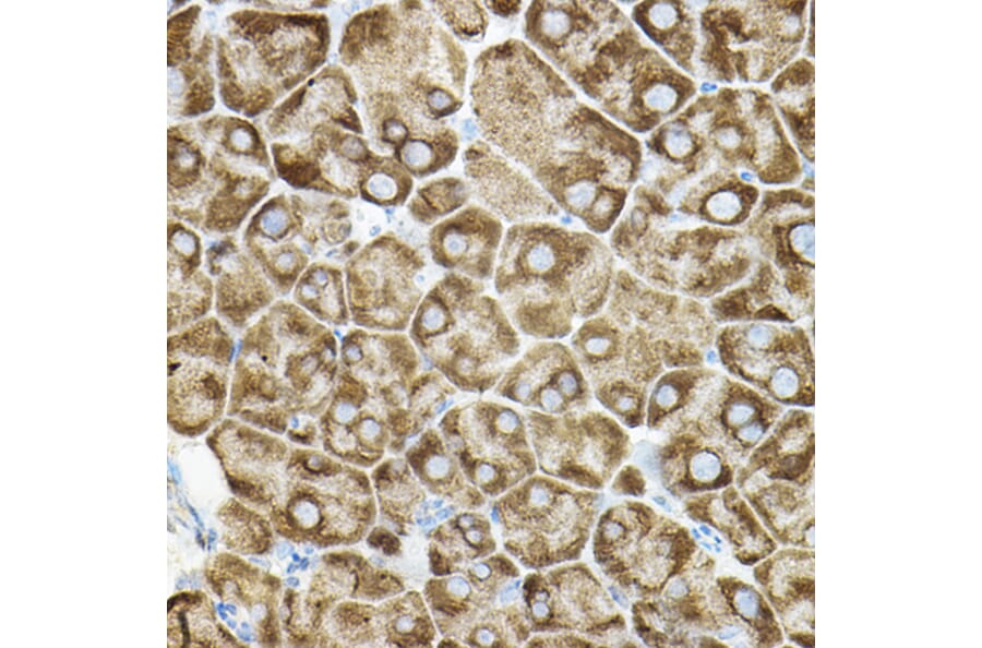 Immunohistochemistry - Anti-ROCK2 Antibody (A14916) - Antibodies.com