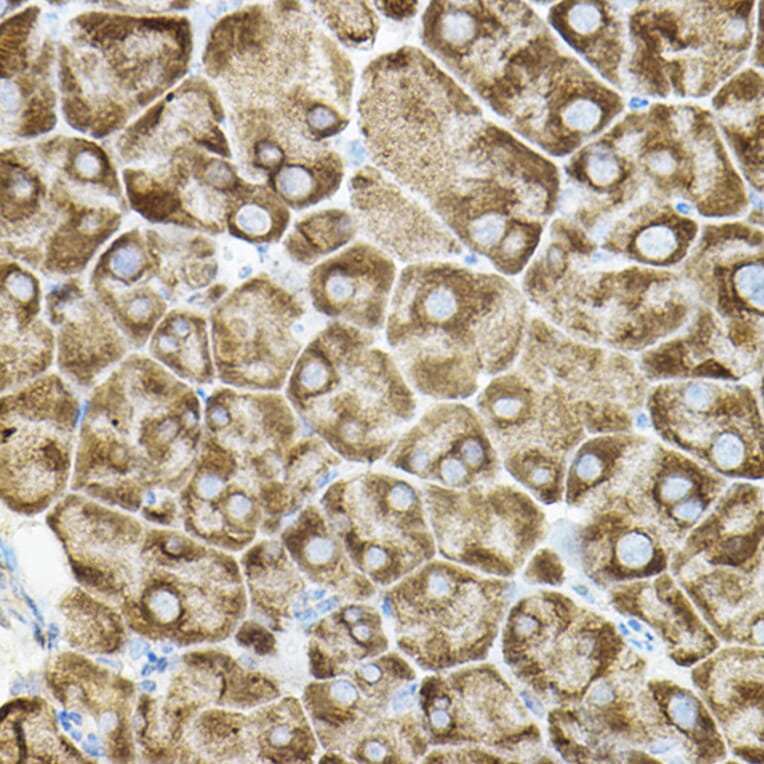 Immunohistochemistry - Anti-ROCK2 Antibody (A14916) - Antibodies.com