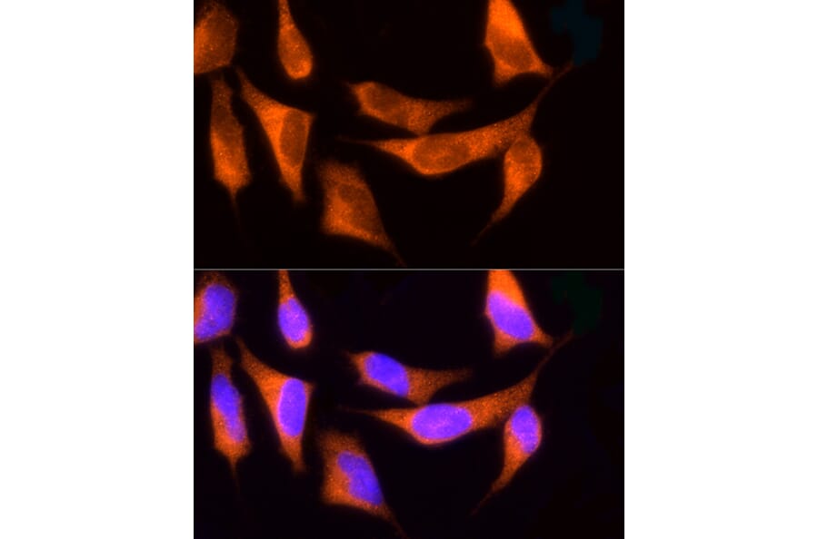 Immunofluorescence - Anti-ROCK2 Antibody (A14916) - Antibodies.com