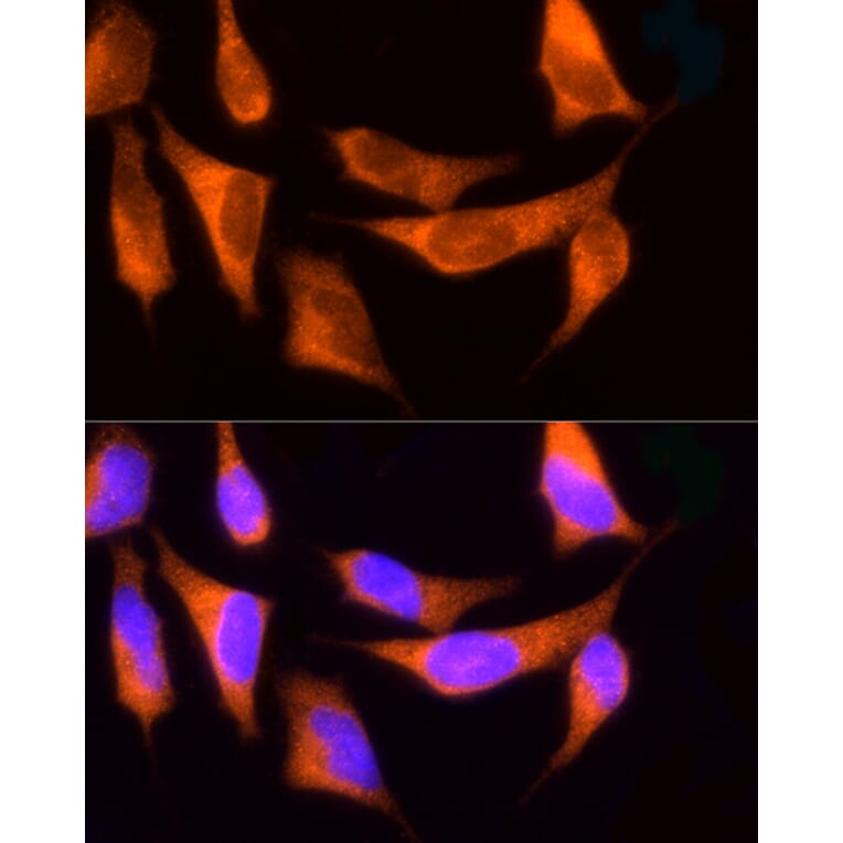 Immunofluorescence - Anti-ROCK2 Antibody (A14916) - Antibodies.com