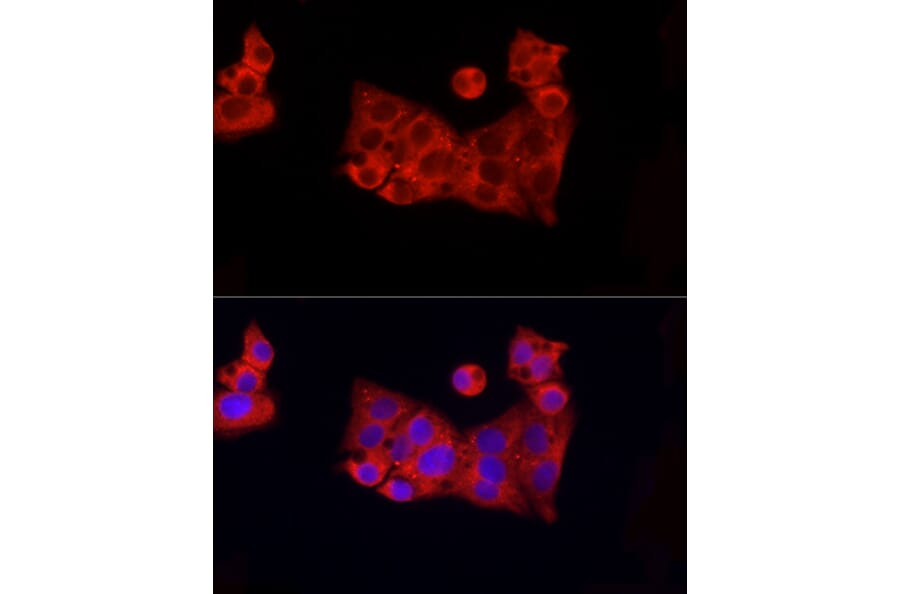 Immunofluorescence - Anti-ROCK2 Antibody (A14916) - Antibodies.com