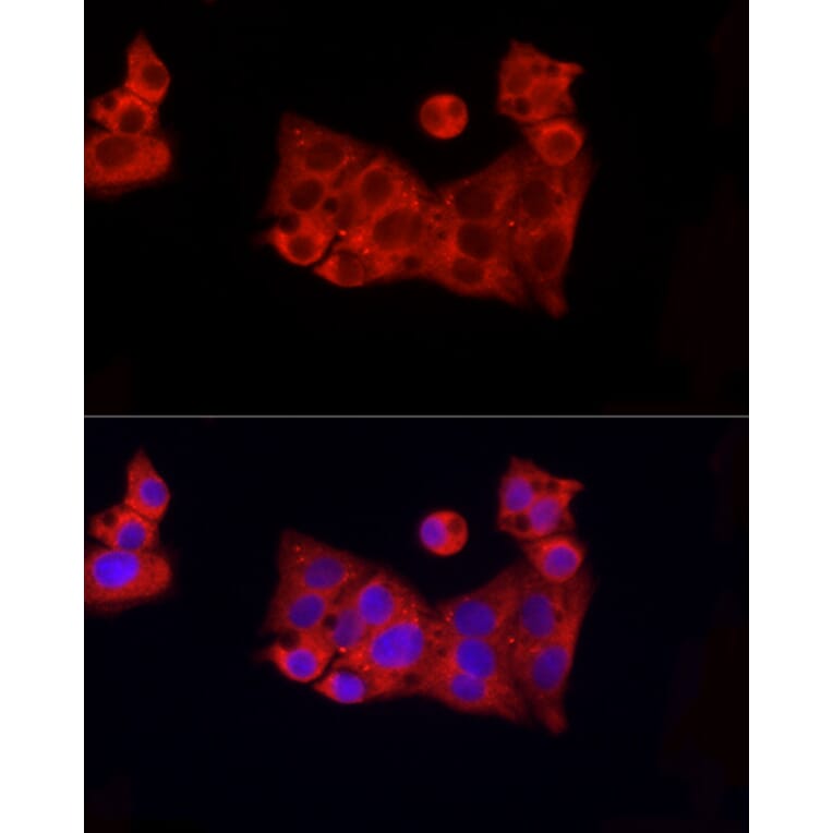 Immunofluorescence - Anti-ROCK2 Antibody (A14916) - Antibodies.com