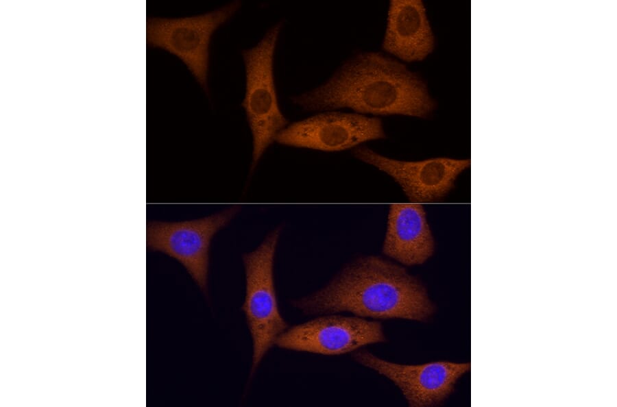 Immunofluorescence - Anti-ROCK2 Antibody (A14916) - Antibodies.com