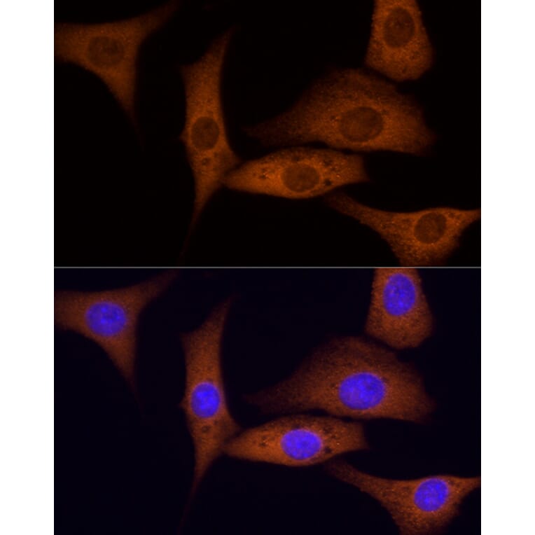 Immunofluorescence - Anti-ROCK2 Antibody (A14916) - Antibodies.com