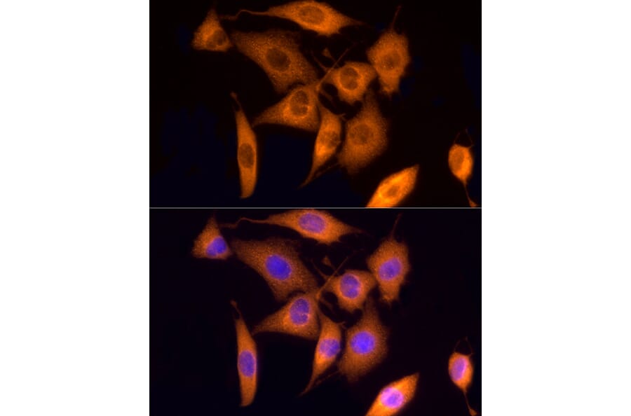 Immunofluorescence - Anti-ROCK2 Antibody (A14916) - Antibodies.com
