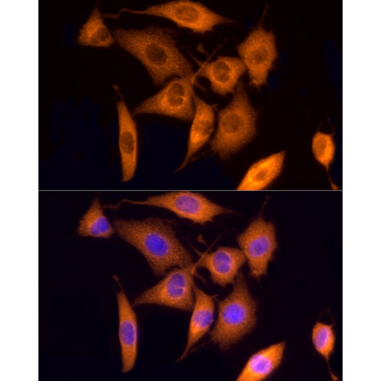 Immunofluorescence - Anti-ROCK2 Antibody (A14916) - Antibodies.com