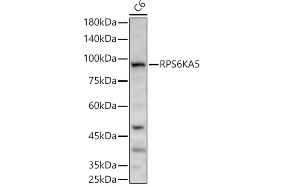 Western Blot - Anti-MSK1 Antibody (A14917) - Antibodies.com