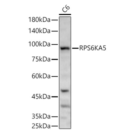 Western Blot - Anti-MSK1 Antibody (A14917) - Antibodies.com
