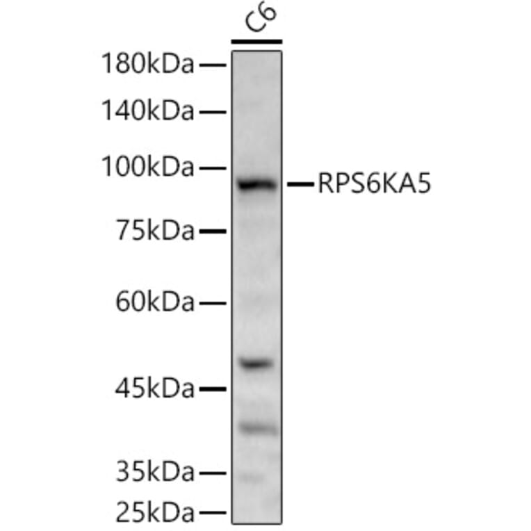 Western Blot - Anti-MSK1 Antibody (A14917) - Antibodies.com