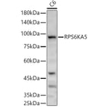 Western Blot - Anti-MSK1 Antibody (A14917) - Antibodies.com