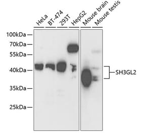 Western Blot - Anti-SH3GL2 Antibody (A14919) - Antibodies.com