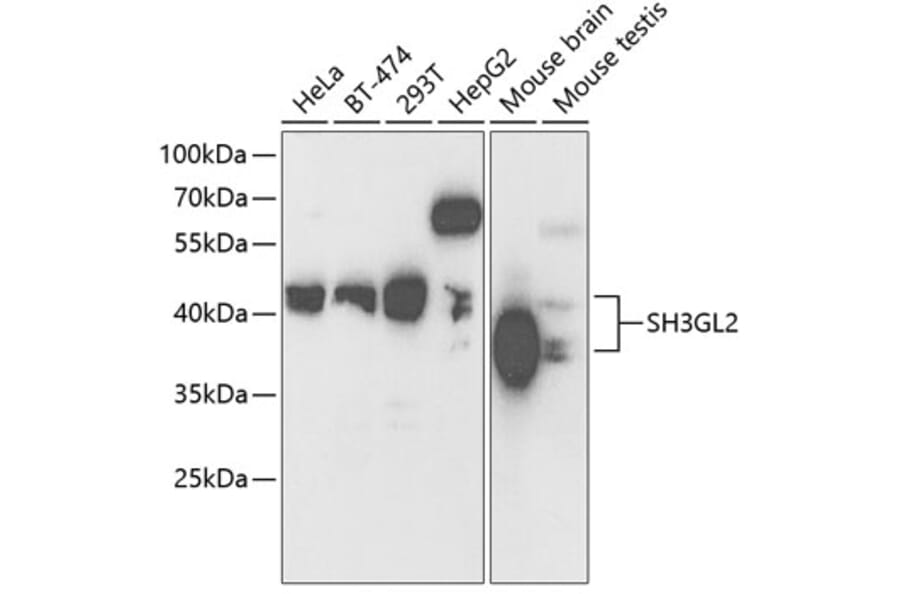 Western Blot - Anti-SH3GL2 Antibody (A14919) - Antibodies.com