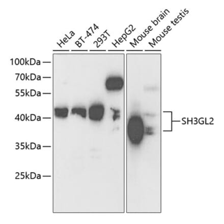 Western Blot - Anti-SH3GL2 Antibody (A14919) - Antibodies.com