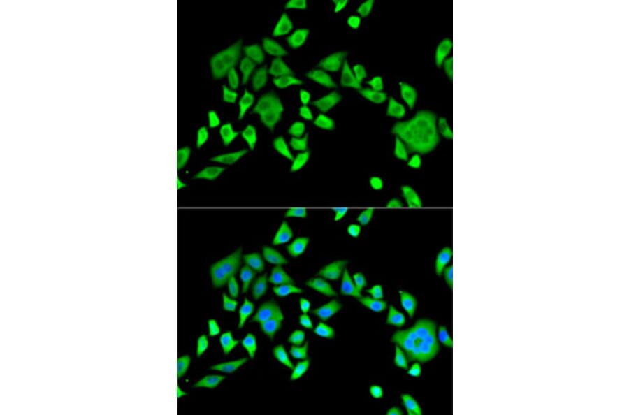 Immunofluorescence - Anti-SH3GL2 Antibody (A14919) - Antibodies.com