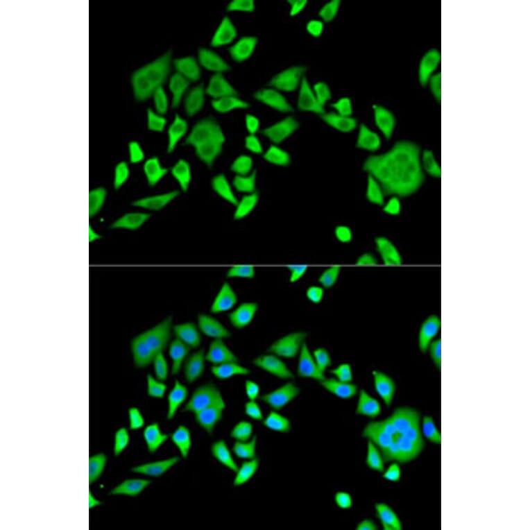 Immunofluorescence - Anti-SH3GL2 Antibody (A14919) - Antibodies.com