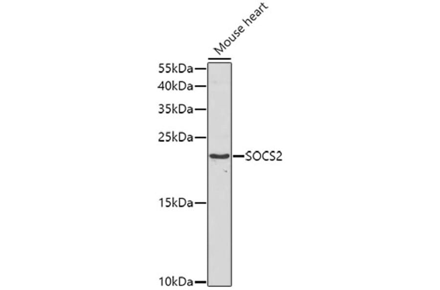 Western Blot - Anti-SOCS2 Antibody (A5703) - Antibodies.com
