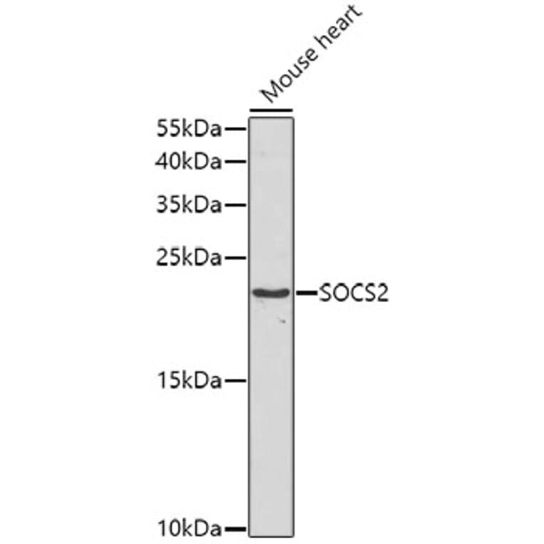 Western Blot - Anti-SOCS2 Antibody (A5703) - Antibodies.com