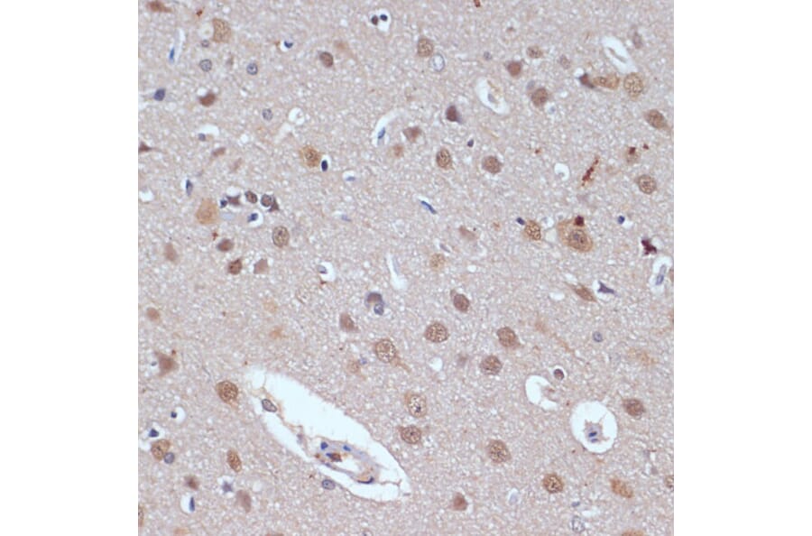 Immunohistochemistry - Anti-53BP2/ASPP2/BBP Antibody (A14921) - Antibodies.com