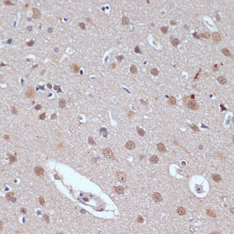Immunohistochemistry - Anti-53BP2/ASPP2/BBP Antibody (A14921) - Antibodies.com