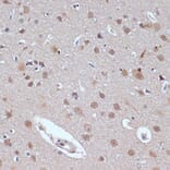 Immunohistochemistry - Anti-53BP2/ASPP2/BBP Antibody (A14921) - Antibodies.com