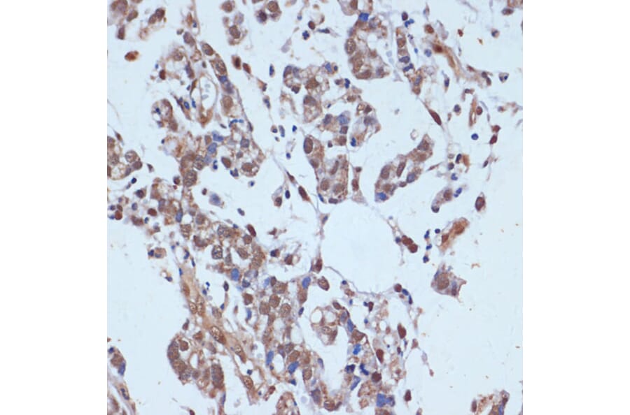 Immunohistochemistry - Anti-53BP2/ASPP2/BBP Antibody (A14921) - Antibodies.com